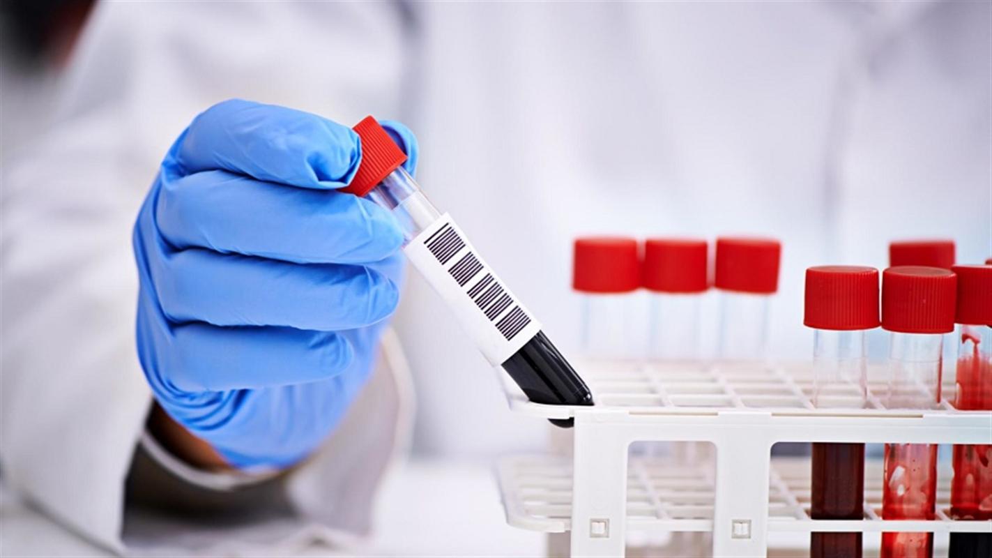 В Костромской области проведено более 80 тысяч тестов на коронавирус